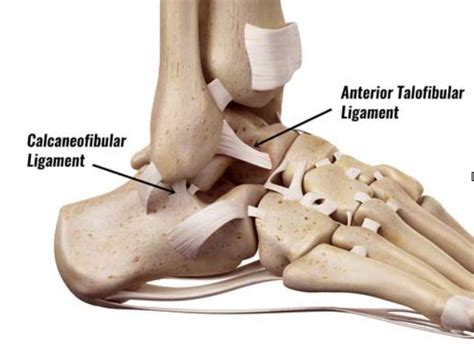 Information on the anterior talofibular ligament provided by the anatomyzone daily feed. Ankle Sprain - Fay Pedler