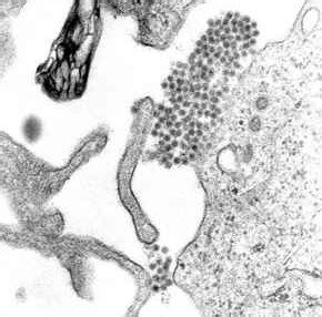 Wie gut wirkt der impfstoff comirnaty? "Erster Dengue-Virus Impfstoff enttäuscht in der Phase IIb ...