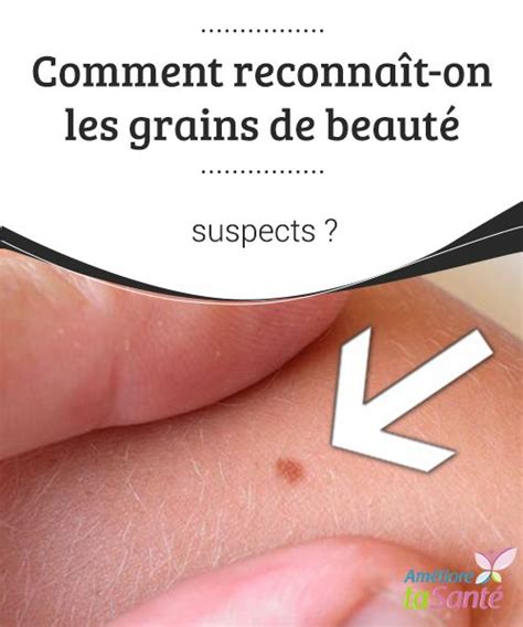 Les grains de beauté sont généralement bénins. Comment reconnaît-on les grains de beauté suspects ...