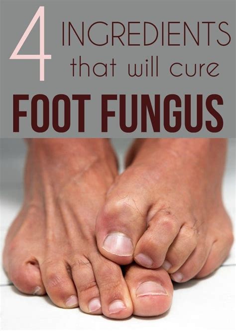 May 25, 2018 · there are a few home remedies for itchy bug bites on your feet. Easy steps to get rid of calluses and toenail fungus. # ...