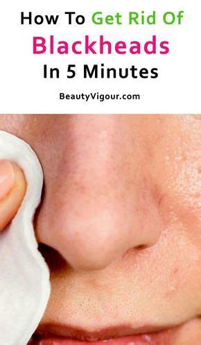 Mix equal parts of raw honey and cinnamon to form a paste. Get Rid Of Blackheads In 5 Minutes | Get rid of blackheads ...