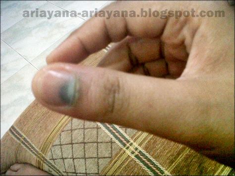 Maybe you would like to learn more about one of these? .yana lyana.: Apa kita perlu buat jika jari tersepit pintu ...