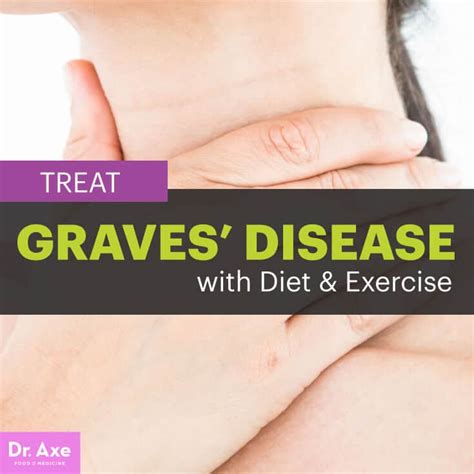 Signs and symptoms, diagnosis and treatment. Graves Disease Natural Treatments, Causes and Diet Plan ...