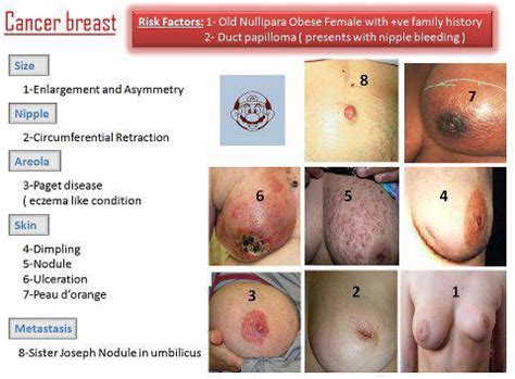 Breast cancer in women can often be tough to detect in its early stages. Part I Breast Cancer Awareness! | Strive For Good Health