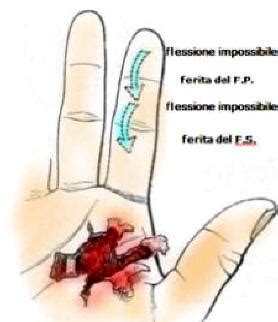 Mano