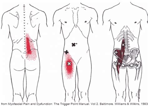 The lower back is complex and can jigsaw puzzle. Pin on Psoas Release