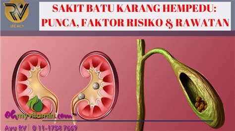 Demam dan menggigil jika terkena jangkitan. RAWAT BATU KARANG HEMPEDU: KETAHUI PUNCA, FAKTOR RISIKO ...