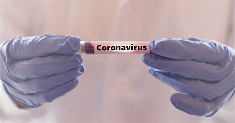 It usually looks like a shortened version of that bank's name. Coronavirus: Informationen für den Pferdesport | FN