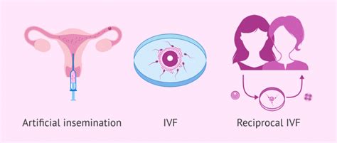 The cost of our surrogacy program, including the provision for choice of possible surrogate mother candidates a. IVF treatment for lesbian couples on NHS