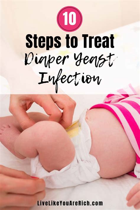 Then i discovered candida and although no doctor has ever. How to Cure Diaper Yeast Infections