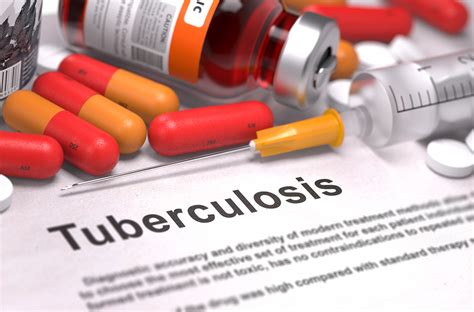 Tuberculosis management refers to the medical treatment of the infectious disease tuberculosis (tb). Homeopathy Helps Treat Drug-resistant Tuberculosis ...