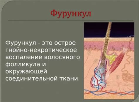 Maybe you would like to learn more about one of these? Под кожей на лице твердый шарик: о чем говорит симптом ...