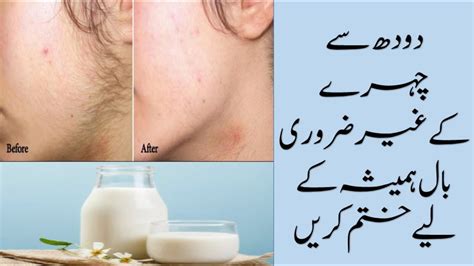 Check spelling or type a new query. How To Remove Face Hair | Face Hair Removal Peel Off Mask | Chehry K Baal Khatam Karne Ka Tarika ...