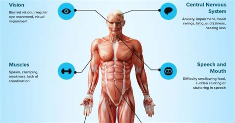 Multiple sclerosis (ms), a condition that affects the central nervous system, is much more common in females than in males, but there is still a risk. Signs and Symptoms of Multiple Sclerosis Infographic