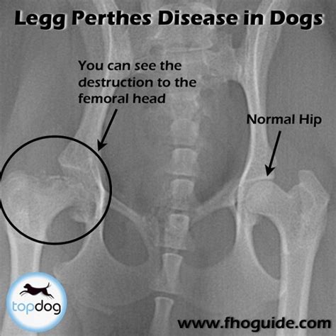 Anlage eines stauschlauchs unterhalb des knies beim stehenden. Legg disease. Causes, symptoms, treatment Legg disease