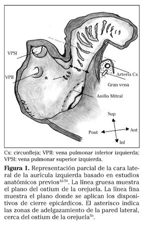 Con este tipo de arritmia, la sangre se queda estancada en la orejuela auricular izquierda (una zona del corazón), por. La orejuela izquierda como fuente de accidentes cerebrovasculares: cerrar (y cómo), o no cerrar ...