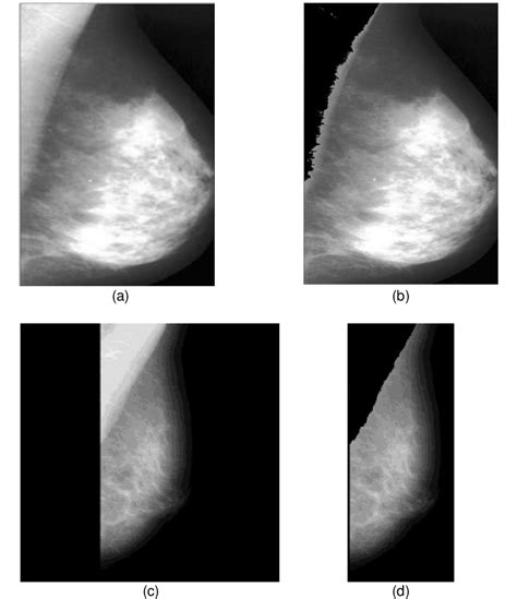 Upper chest, lower chest, etc), while the other claims that you can. Pectoral muscle separation. (a) Image with pectoral muscle ...