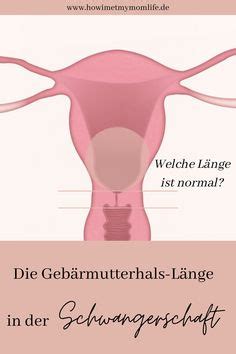 Ich wurde auch mit ks geholt und hab auch kein schaden davon getragen ;).wieso hat denn dein arzt gesagt, dass es. 35+3 - Wie mein Sohn Christian auf die Welt kam! Not ...