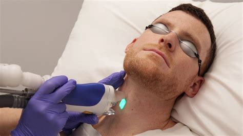 During laser hair removal, a laser emits a light that is absorbed by the pigment (melanin) in the hair. Men's Laser Hair Reduction with Splendor X at Azura Skin ...