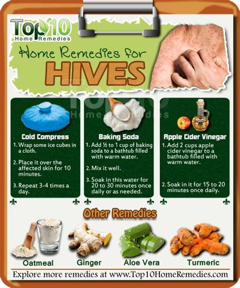 Skin allergy causes the skin to become irritated, itchy, dry and flaky. Home Remedies for Hives | Top 10 Home Remedies