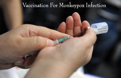Wild animals are the most common method of transmission, though the virus can be spread from one. Monkeypox - Causes, Symptoms, Signs, Diagnosis, Treatment ...