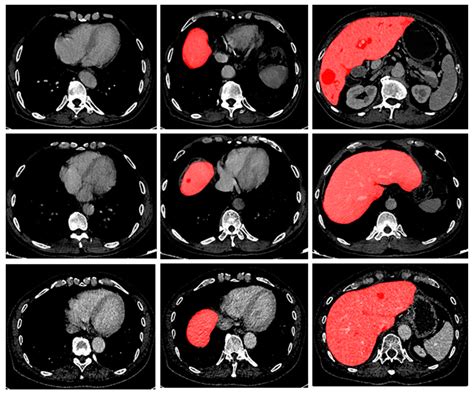 Check ct scan cost,ct scan price near me, rate in delhi, faridabad,ncr. Ct Scan Training Near Me - ct scan machine