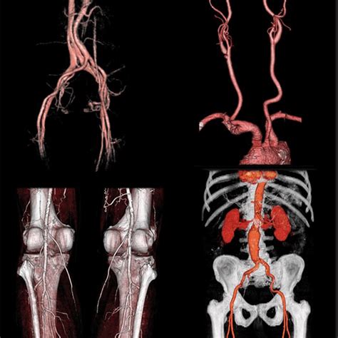 Maybe you would like to learn more about one of these? КОМПЬЮТЕРНАЯ ТОМОГРАФИЯ - КТ - Radiologisches Zentrum ...