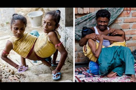 Bukan hanya melakukan interaksi setiap hari, ternyata mengenali pasangan juga bisa dilakukan dengan cara mengenali seperti apa zodiaknya, termasuk jika ingin mendekati pria berzodiak cancer. Pria ini Jatuh Cinta kepada Kembar Siam, Tapi Tak Disangka ...