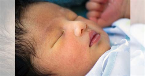 Bagi bayi yang baru lahir, demam kuning atau jaundice adalah di antara perkara paling serius yang perlu diperhatikan. Gambar Bayi Kuning - GAMBAR TERBARU HD