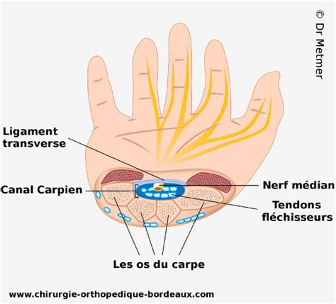 Le canal carpien est un tunnel situé à la face antérieure du poignet. Soulager le Syndrome du canal carpien - Dr Metmer