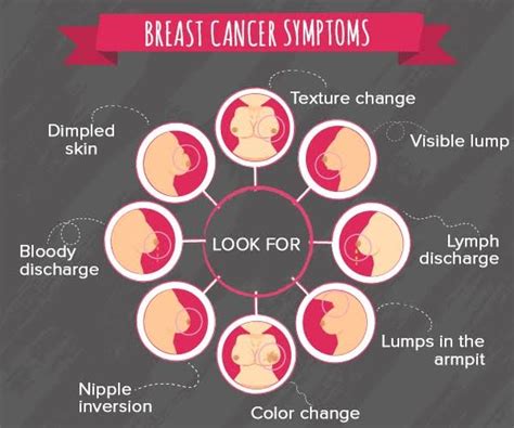 Pain is the most common sign of bone cancer, and may become more noticeable as the tumor grows. BREAST CANCER -IT HAS A CURE