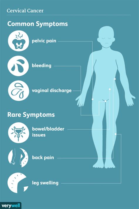 Cervical cancer is caused by the human papillomavirus (hpv). Cervical Cancer Signs, Symptoms, and Complications