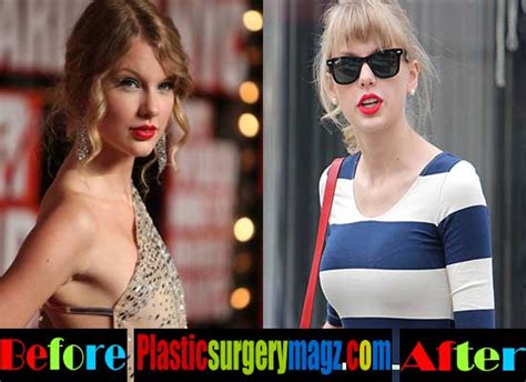 Taylor Swift Boob Job Before and After Pictures ...