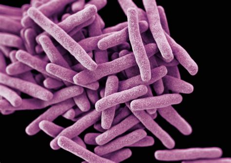 Tb or tb may refer to: Ending TB: the race to control a disease in hiding | LSHTM