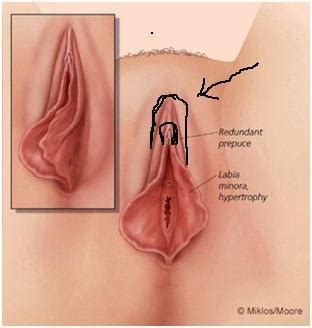 Männer sind die unterschiedlichen aussehensweisen der schamlippen gewohnt, z.b. meine schamlippen sehen irgendwie sehr komisch aus ...