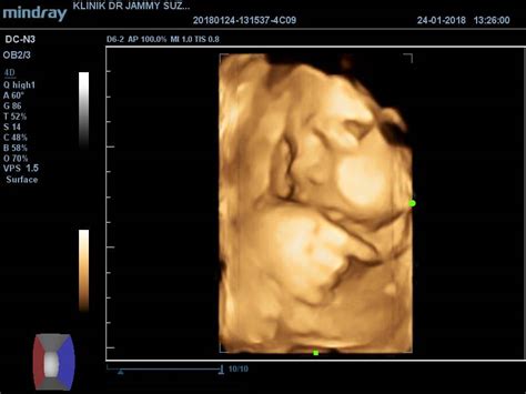 Ibu jari memiliki makna filosofis, yaitu tentang kehadiran dan peran sang ibu dalam rumah tangga yang bisa kita refleksikan dalam kehidupan. Farah Shahirah: Pengalaman Scan 2D/3D/4D *First Baby