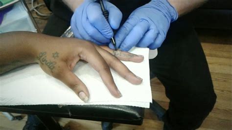 The next section of the website is about what you can do to prevent tattoo infections. Tattoo Removal, Laser Free, Scar Free & only in Athens, GA ...