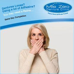 10 can you reline dentures at home. How Do I Tighten My Dentures? | Patient Education/FAQs | Mile Zero Denture Clinic