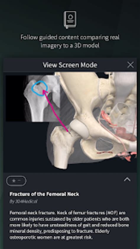 Essential anatomy 5 is a complete anatomy app that features more than 8.000 structures that you can consult with its very accurate and immersive this is an excellent app for anatomy students. Complete Anatomy 19 for Android APK for Android - Download