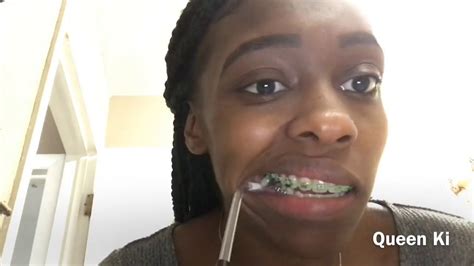 By removing plaque daily you are keeping your teeth & gums healthy. Brushing my teeth with Braces |Detailed| - YouTube