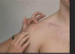 It serves as the insertion site for the subscapularis muscle. UQ - Palpation Flashcards | Quizlet